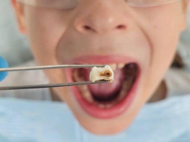 Best Cosmetic Emergency Dentistry in Purvis, MS